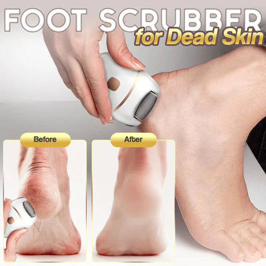 🔥HOT SALE 49% OFF🔥Rechargeable Electric Foot Exfoliating Scrubber